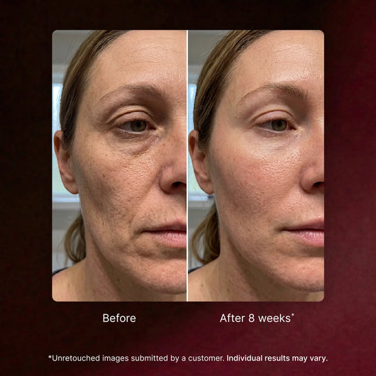 Astaxanthin Capsules