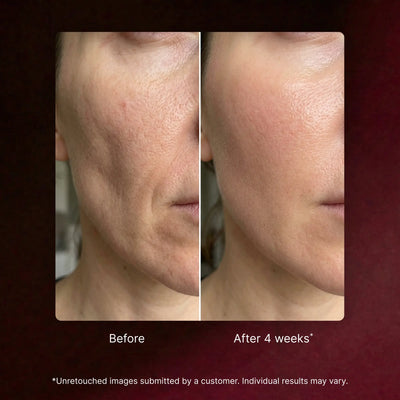 Astaxanthin Capsules